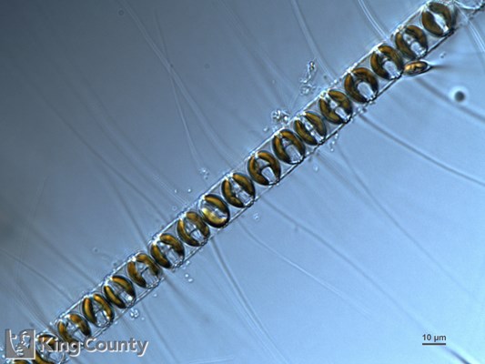 Photo of Chaetoceros vanheurckii